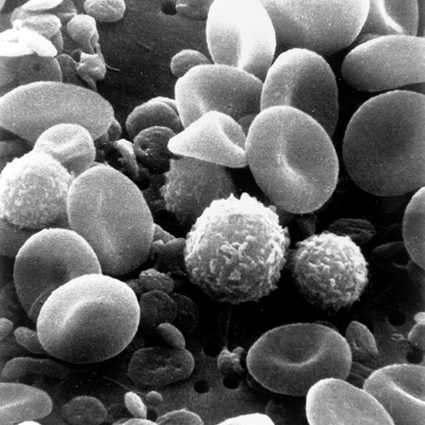 celle a combustibile microbiche, celle a combustibile sangue umano, celle a combustibile microbiche nel sangue, energia elettrica dal sangue umano