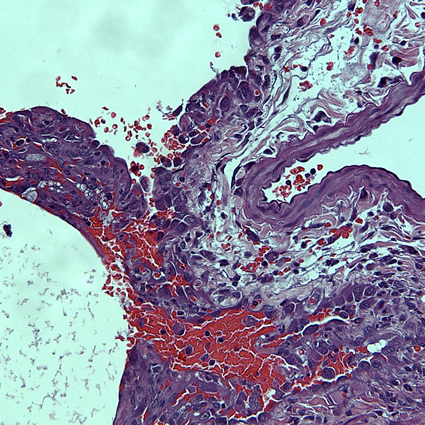 paraquat_maneb_pesticidi_tossici_parkinson_paraquat_4 (1)