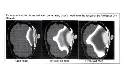 cellulare_tumore_cancro_cervello_cellulari_telefoni_mobili_cancro_tumori_cervello_dispositivi__mobili_onde